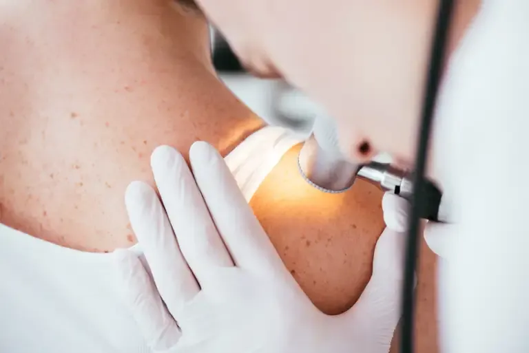 Doctor examining a patient's skin as part of deep learning-based melanoma detection research.